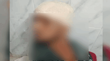 মাধবপুরে বন প্রহরীকে কুপিয়ে জখম