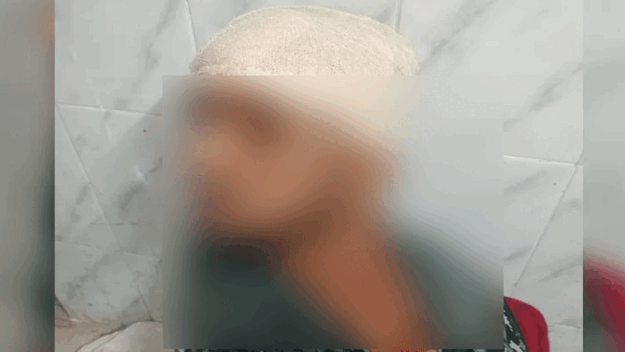 মাধবপুরে বন প্রহরীকে কুপিয়ে জখম
